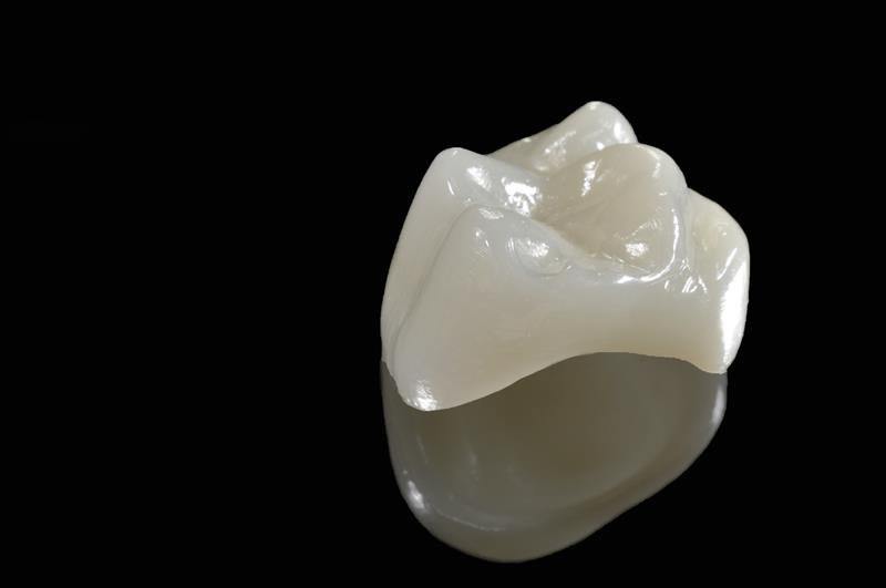 Porcelain Crowns  Virginia Beach, VA